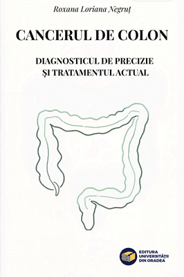 Cover of Cancerul de colon. Diagnosticul de precizie și tratamentul actual